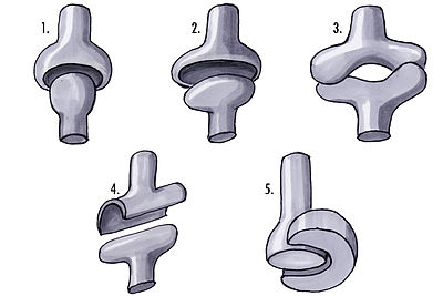 Joints: 1-Ball and socket; 2-Ellipsoid; 3-Saddle; 4-Hinge; 5-Pivot